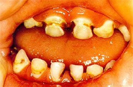 teeth (Custom).jpg